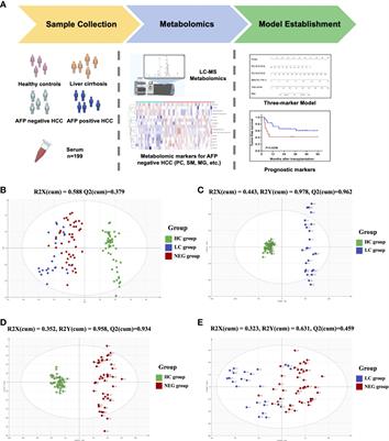 Metabolomic biomarkers for the diagnosis and post-transplant outcomes of AFP negative hepatocellular carcinoma